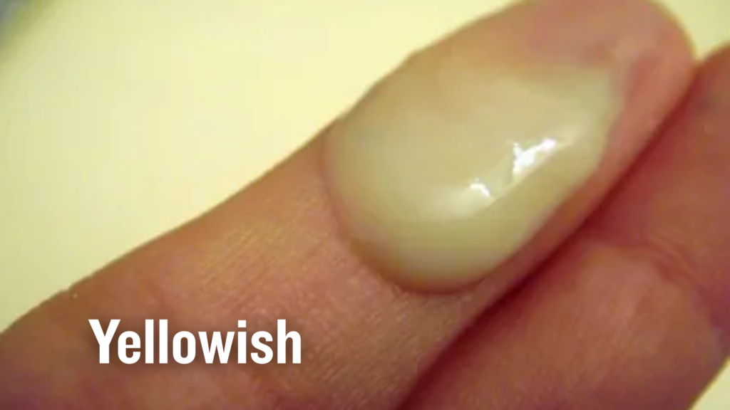 yellowish semen